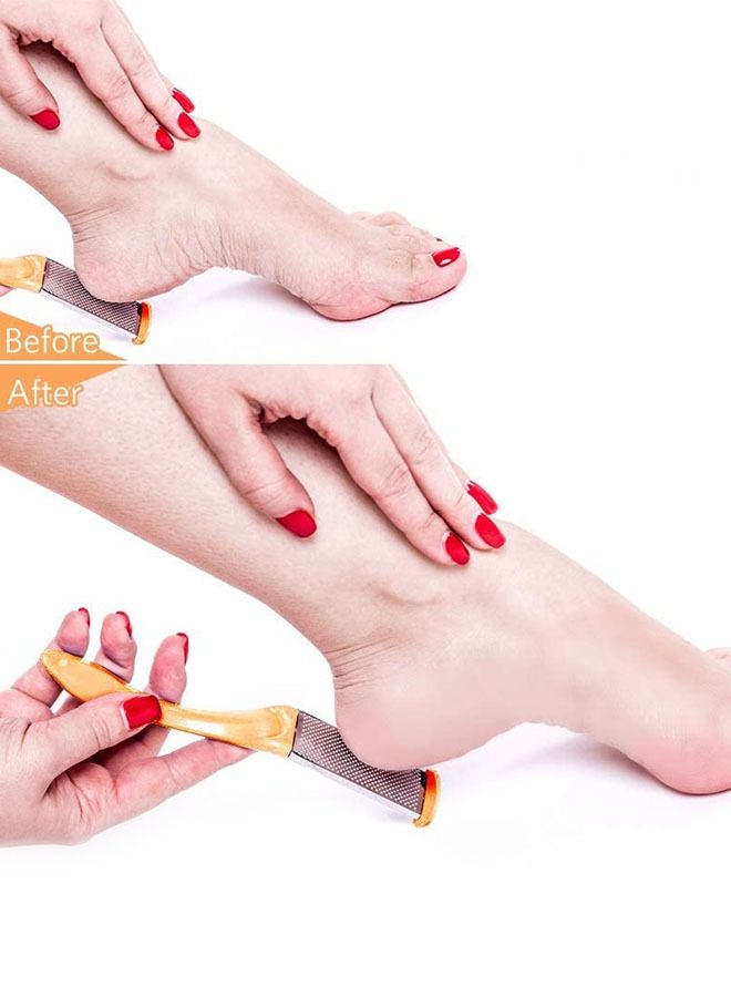 Generic 10 Piece Professional Pedicure Foot Care Tool Set, Foot Rasp Dead Skin Remover Pedicure Kit (Yellow)  - Image 4