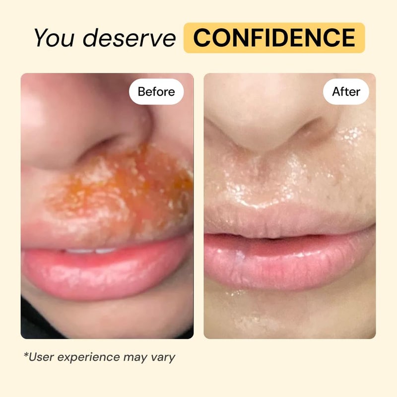 MyMagicHealer Universal Flare Care | Essential Oil Free | Baby Dermatitis, Diaper Rash, Eczema, Psoriasis, Impetigo | Wound Care | Multi-purpose Solution for Sensitive Skin w/Propolis & Egg Yolk 1 oz - Image 5