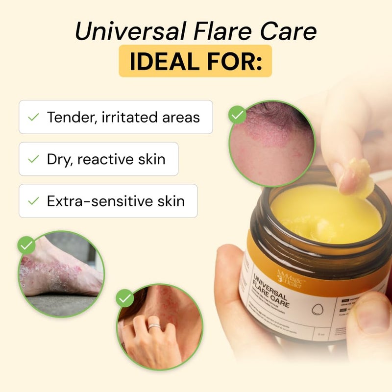 MyMagicHealer Universal Flare Care | Essential Oil Free | Baby Dermatitis, Diaper Rash, Eczema, Psoriasis, Impetigo | Wound Care | Multi-purpose Solution for Sensitive Skin w/Propolis & Egg Yolk 1 oz - Image 2