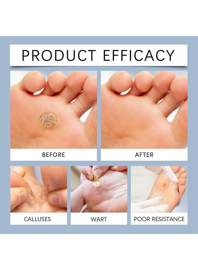 MQFORU 24 Pcs Foot Corn Removal Plaster, Corn Callus Treatment for Feet, Foot Care Cushions fir Relief Pain From Calluses Corns Blisters - Image 3