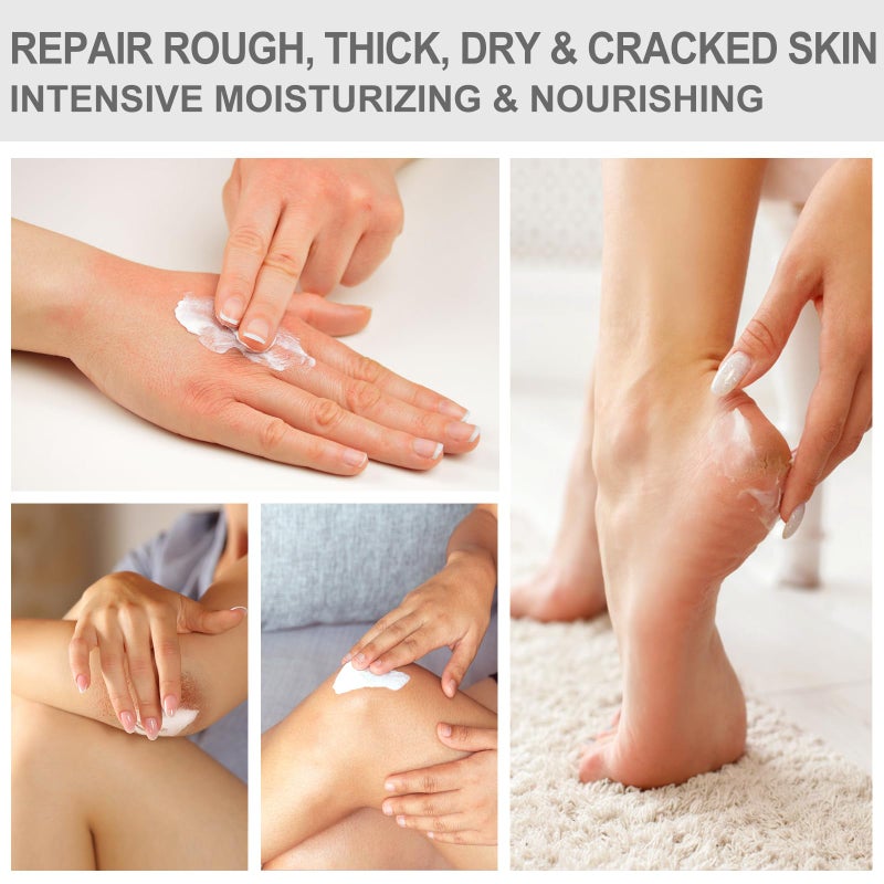 Mouriven Urea Cream 40 Percent - Foot & Hand Cream for Dry, Cracked Heels, Feet, Knees, Elbows, and Hands - Maximum Strength Urea Lotion for Softening and Moisturizing - Image 4