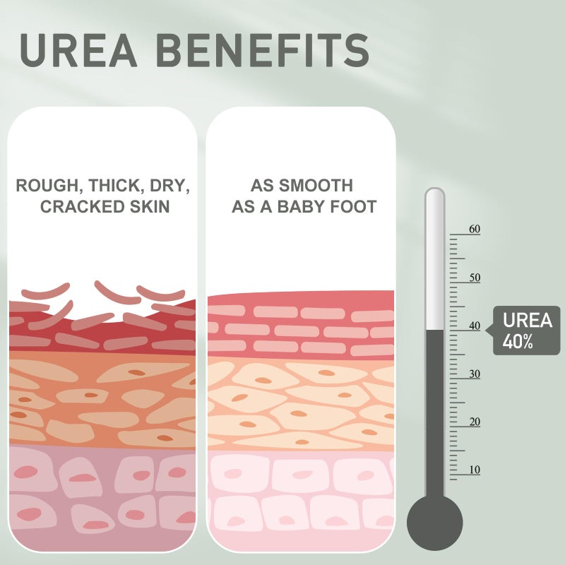 Mouriven Urea Cream 40 Percent - Foot & Hand Cream for Dry, Cracked Heels, Feet, Knees, Elbows, and Hands - Maximum Strength Urea Lotion for Softening and Moisturizing - Image 3
