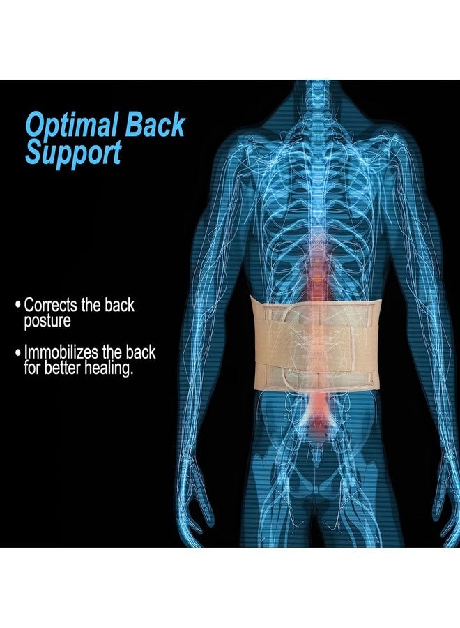MEDTRIX LS Back Support Belt for Lower Back Pain Relief - Adjustable Lumbar Support Belt for Men & Women UNIVERSAL - Image 3