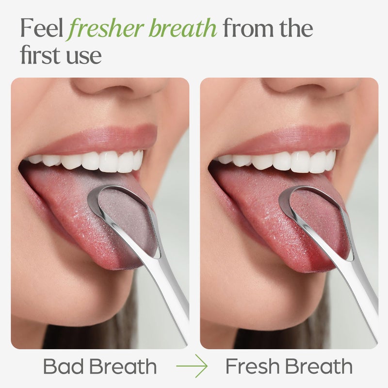 VIVAGO Tongue Scraper for Adults with Holder (2 Pack) - Metal Tongue Scraper for Tongue Cleaning and Reducing Bad Breath - Stainless Steel Tongue Scraper for Adults, Tongue Cleaner for Adults - Image 4