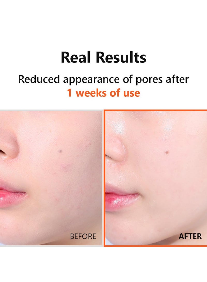 ايسنتري سيروم هايبر نياسيناميد 20% 20 مل - Image 4