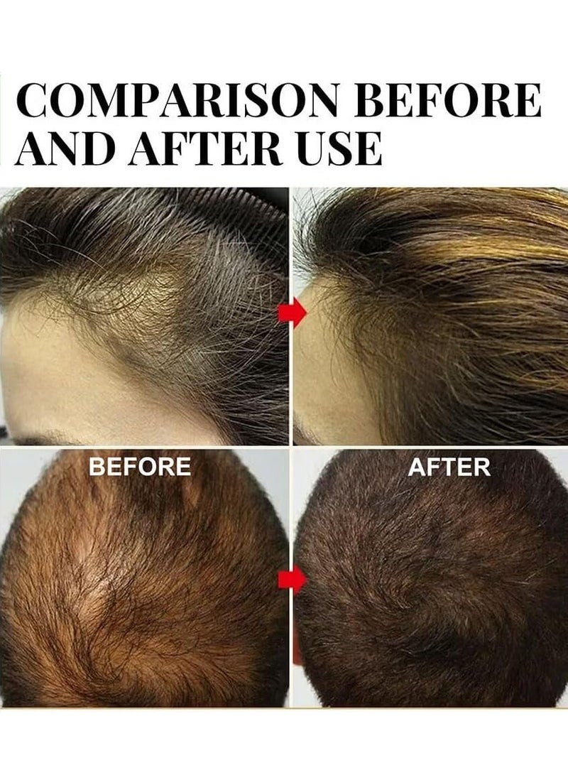 إيلهو زيت إكليل الجبل للعناية بالشعر يساعد على نمو الشعر وتقويته 30 مل - Image 4