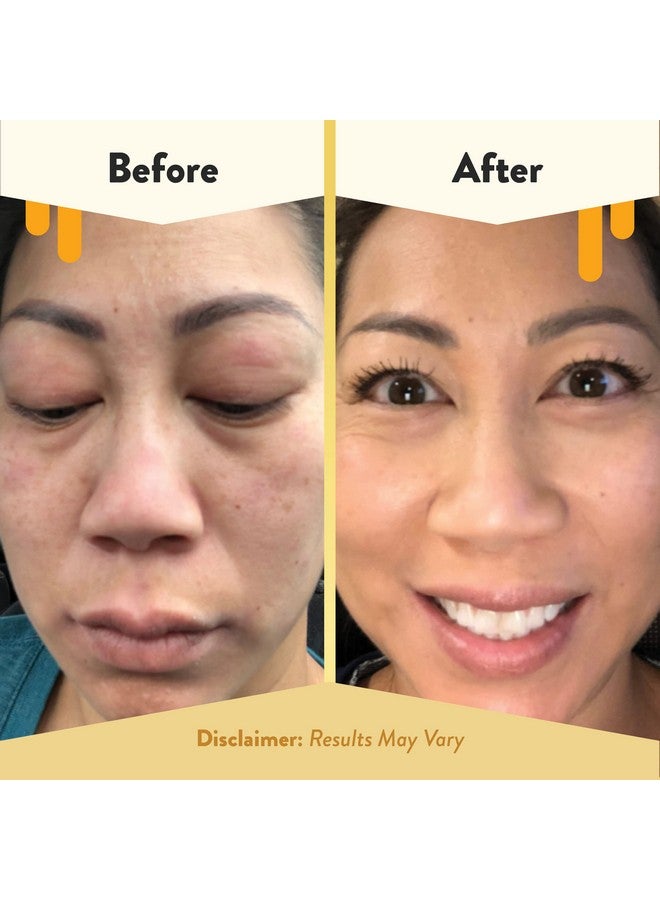 ECZEMA HONEY Soothing Facial Cream - Eczema Lotion for Face, Eyelids, Lips, and More - Natural Dry Skin Repair (2 Oz) - Image 4