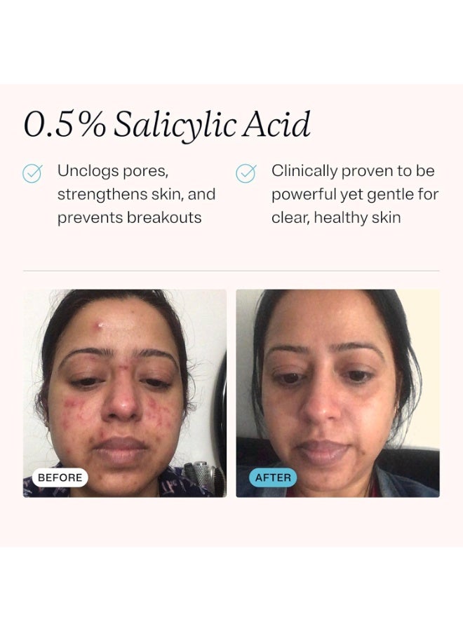 MDacne منظف وجه مرطب MDacne مع حمض الساليسيليك المجهرى 0.5% - علاج حب الشباب بمكونات نباتية لإزالة الأوساخ والزيوت، حماية البشرة وفتح المسام - يهدئ الاحمرار والالتهاب - Image 3
