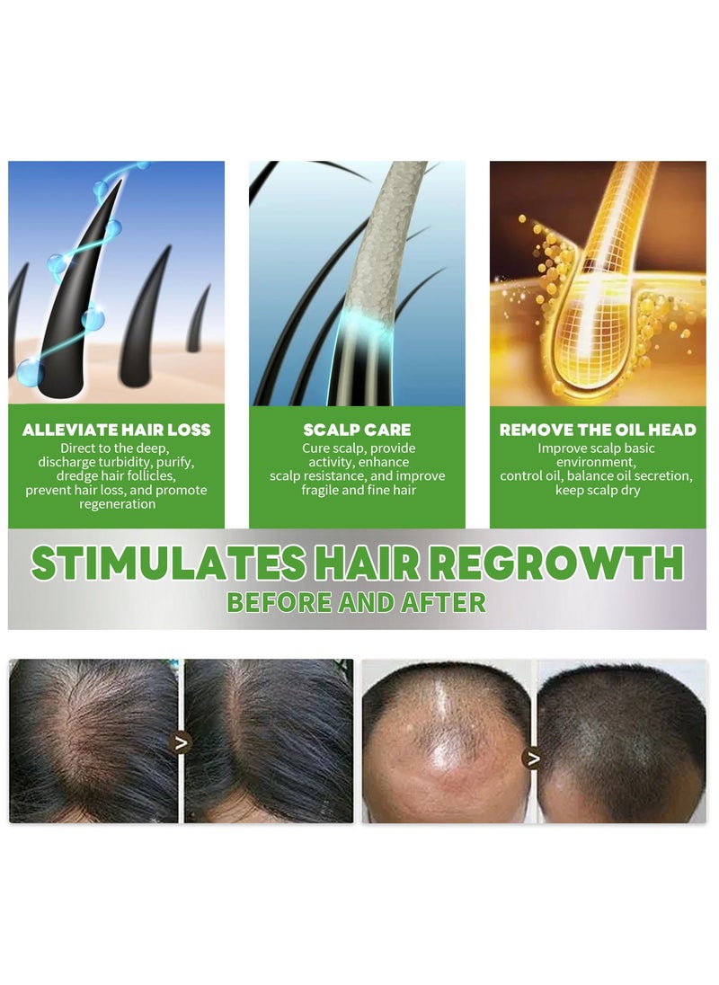 West&Month Prevent Hair Loss And Strengthen Hair Hair Care Spray 30ml  - Image 4