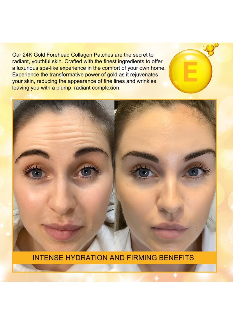 Yecuce 12Pcs 24K Gold Forehead Collagen Patches Forehead Wrinkle Patches with Aloe Vera Collagen Shea Butter and Vitamin E Smooth Fine Line and Wrinkles Anti Wrinkle Forehead Wrinkle Treatment Patch  - Image 5