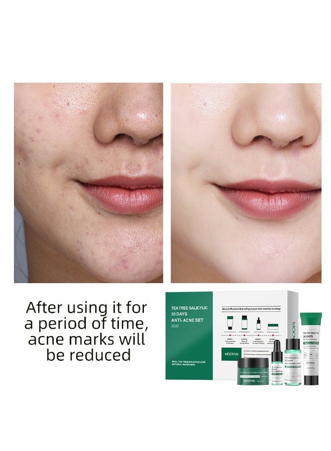 MOOYAM Tea Tree Salicylic 30 Days Anti Acne Set Tea Tree Acne Treatment Skin Care Kit - Image 5