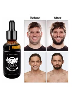 General Mens Beard Growth Kit, Beard and Mustache Facial Hair Growth Roller Kit, Beard Growth Oil, Beard Balm, Beard Roller, Beard Comb, Storage Bag, Birthday Gift for Father Dad Men  - Image 3
