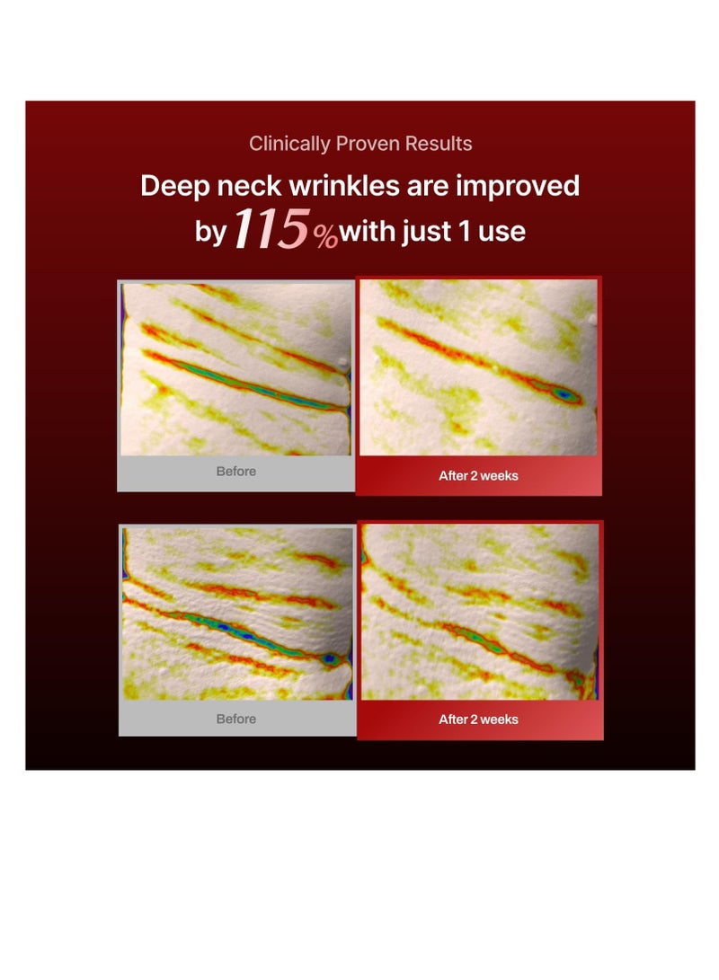 MEDITHERAPY Wrinkle fit Korean Mesh Sheet Masks for Neck | 7EA - Image 4