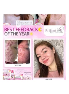 Brilliant Skin Brilliant Skin facial Whitening Set  - Image 2