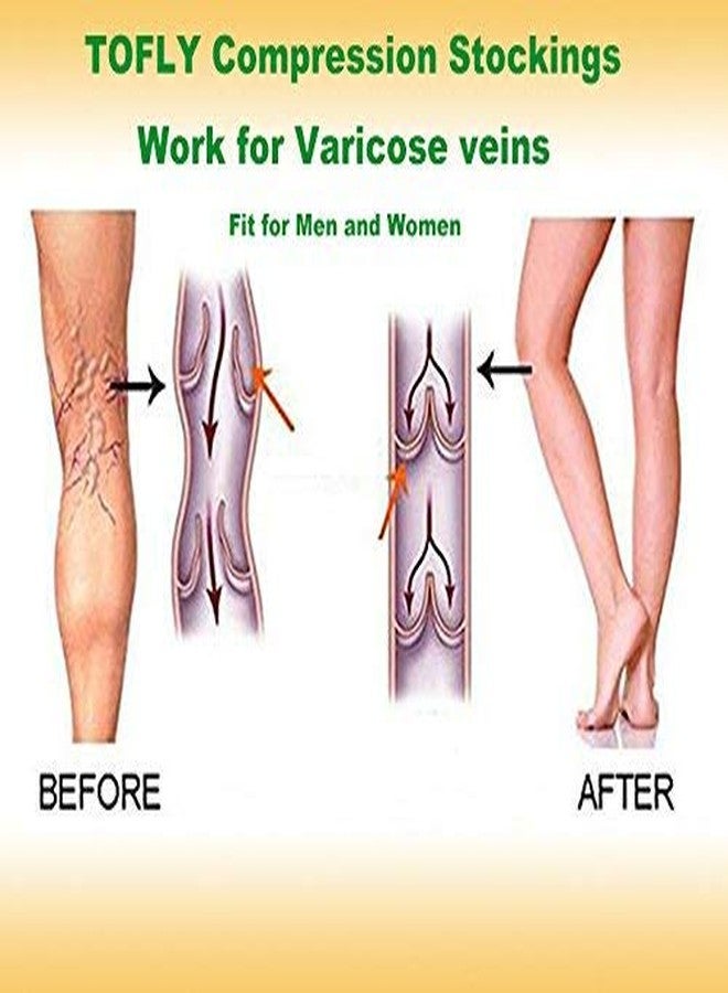 TOFLY Medical Compression Socks 15-20mmHg for Women & Men, Knee High Open Toe Graduated Compression Stockings for Pregnancy, Nurses, Varicose Veins, Swelling, Edema, Beige XL - Image 5