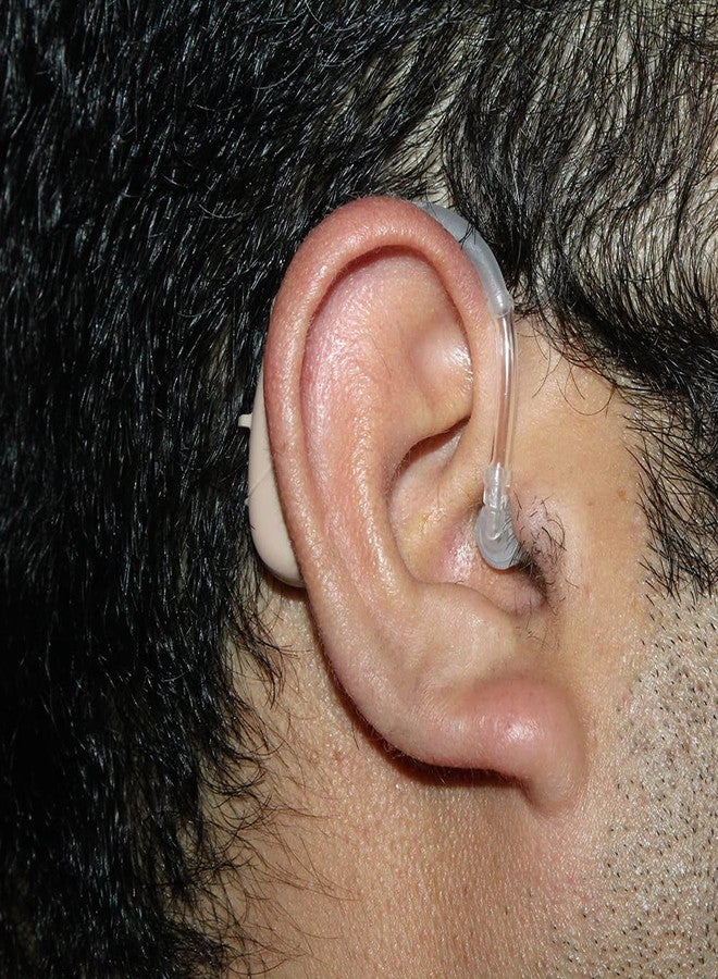 أف سي أس سماعة أذن FCS (Gold P) خلف الأذن، تناظرية، سهلة التركيب، مناسبة لفقدان السمع المتوسط إلى الشديد (ضمان البائع لمدة عام واحد) - Image 3