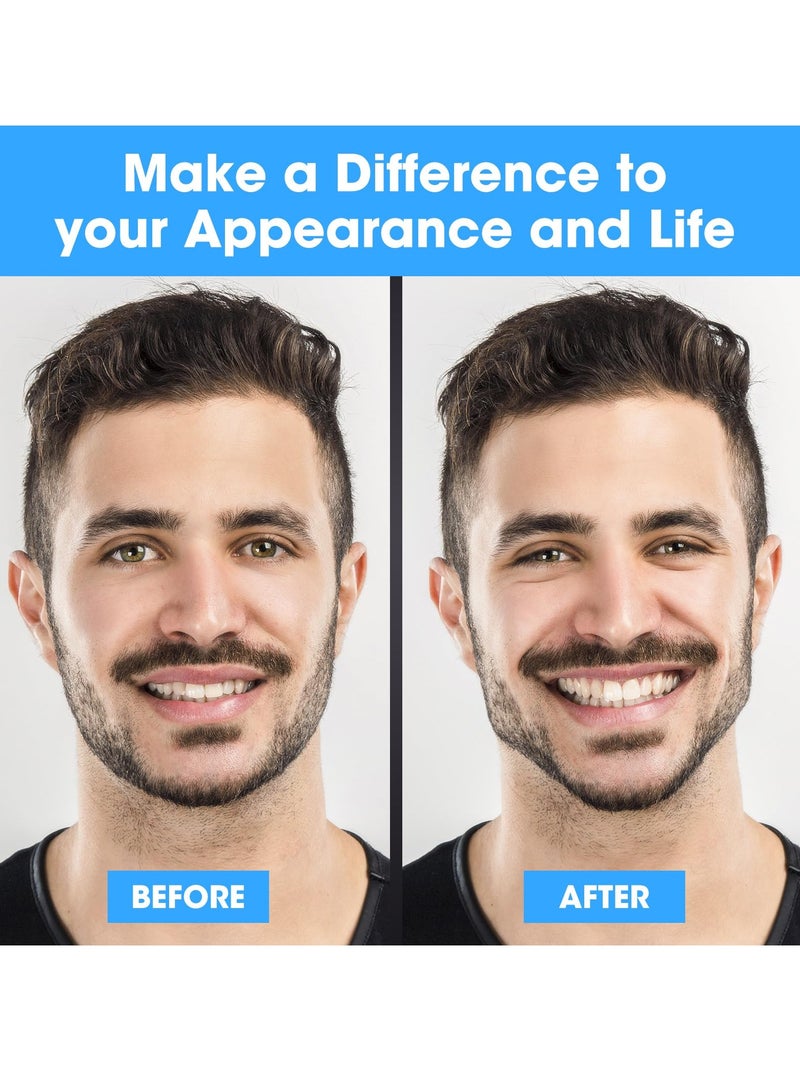 2024 Upgraded Jaw Exerciser for Men u0026 Women 6pcs 3 Resistance Levels, Silicone Jawline Exerciser Jaw Trainer Strengthener Jawline Shaper for All Level Users BPA Free Blue Red Black