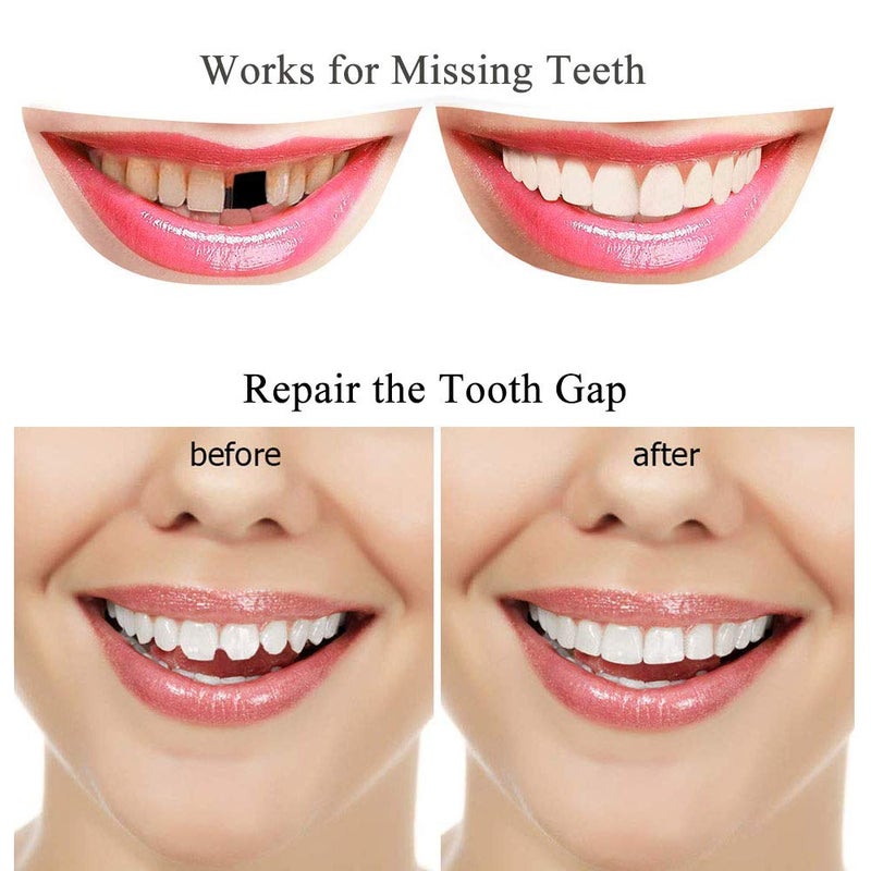 Brige Tooth Repair Kit-Thermal Beads for Filling Fix The Missing and Broken Tooth or Adhesive The Denture Fake Teeth - Image 3