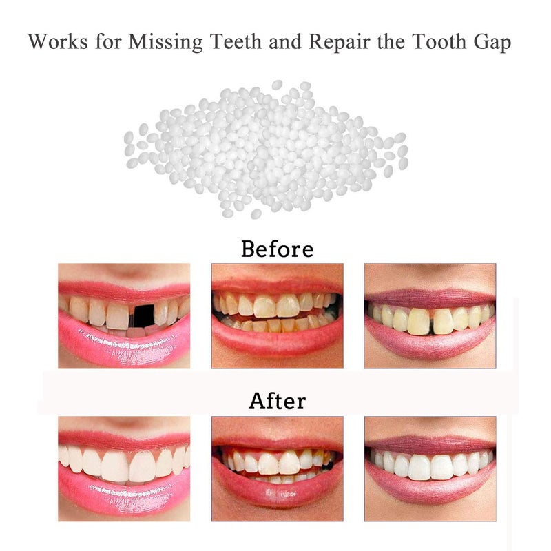 Brige Tooth Repair Kit-Thermal Beads for Filling Fix The Missing and Broken Tooth or Adhesive The Denture Fake Teeth - Image 2