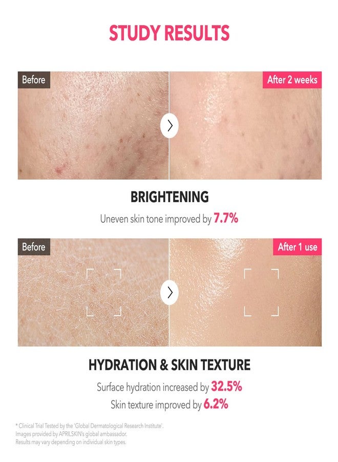 APRILSKIN TXA+Niacinamide 99 Pink Milky Toner | 99% High-Purity TXA 3%+ Niacinamide 5% for Brightening | Highly Concentrated Cream Toner | Deep Moisturizing Formula for Dull Skin | 5.07 fl.oz. - Image 5