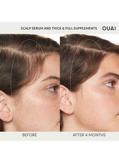 Ouai Thicker, Healthier Hair Scalp Serum, Balanced and Moisturizing Formula for Thicker, Thicker Hair,Fuller Hair-2 fl oz - pzsku/Z9B95E28267686EF45139Z/45/_/1722673458/81496768-6b5f-4532-8f8d-40b48b2a8b88