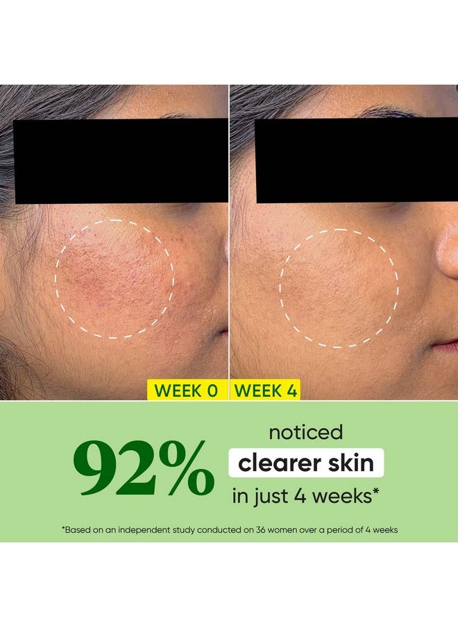 Dot & Key Cica + Niacinamide Oil-Free Face Moisturizer For Calm, Acne Free Hydrated Skin Fades Acne Scars & Dark Spots, Soothes Redness & Irritation | For Oily, Acne Prone & Sensitive Skin | 60Ml Jar  - Image 3