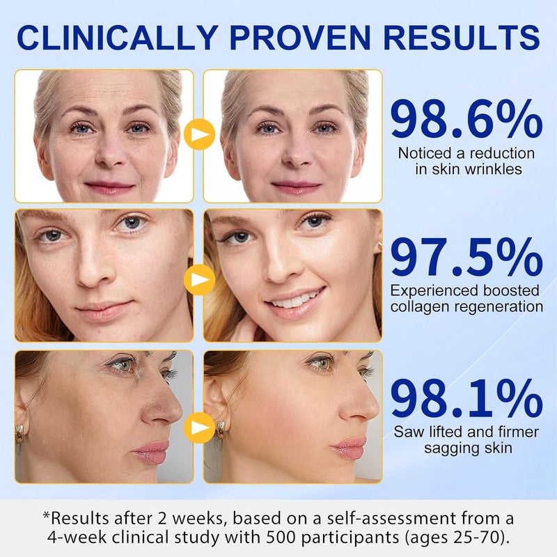 TKTALKER عصا شد الوجه المتقدمة بالريتينول غنية بمضادات الأكسدة والببتيدات لشد التجاعيد وخطوط الضحك بشكل مرئي نتائج ملحوظة في 34 أسبوع 10 أونصات - Image 5