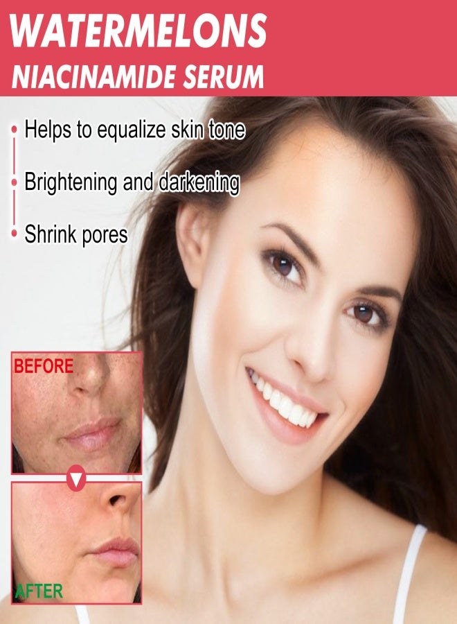 Generic Watermelon niacinamide essence, suitable for moisturizing, whitening and oil removal - 60ml  - Image 4