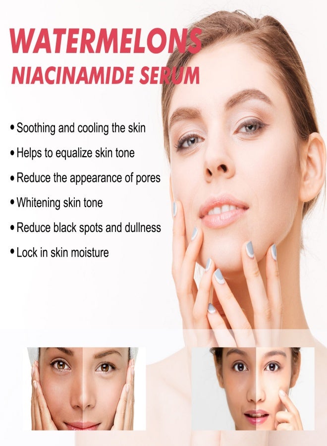 Generic Watermelon niacinamide essence, suitable for moisturizing, whitening and oil removal - 60ml  - Image 2