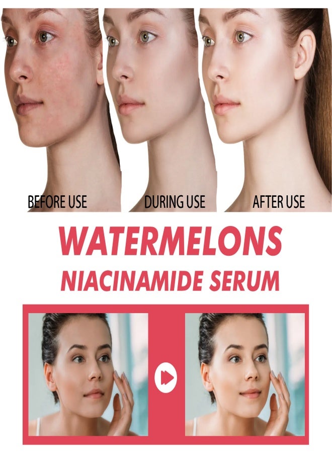 Generic Watermelon niacinamide essence, suitable for moisturizing, whitening and oil removal - 60ml  - Image 3