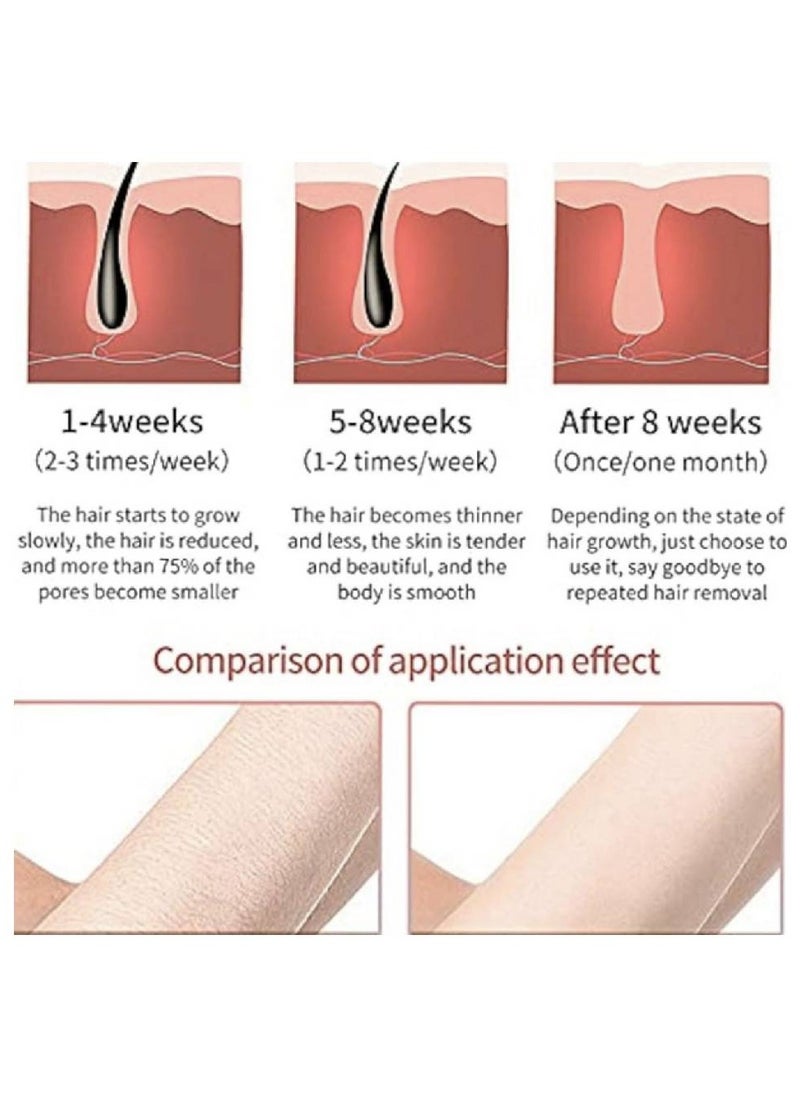 sokany - SOKANY Painless Laser Hair Remover - Image 1