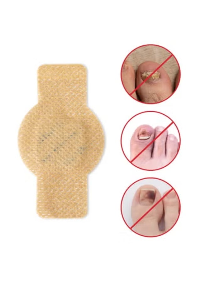 لصقات مضادة للبكتيريا لصحة الأقدام، تأثير مضاد للبكتيريا طويل الأمد، علاج عدوى البكتيريا، استعادة صحة القدمين، 21 قطعة - Image 3