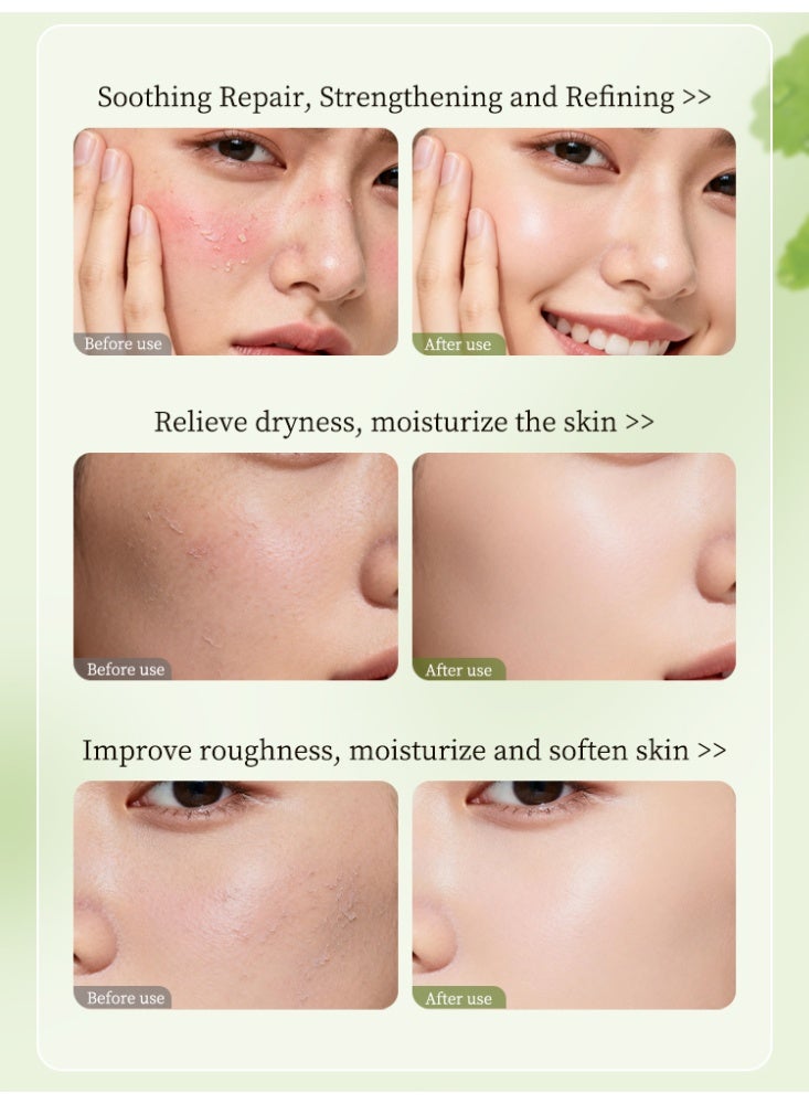 LYDIMOON Centella Asiatica Soothing Repair Serum Redness Calming Barrier Repair Dryness Relief For Sensitive Skin 30ml - Image 5