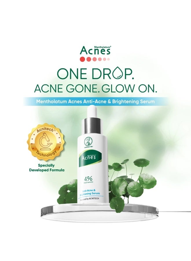 Mentholatum Acnes Anti-Acne & Brightening Serum 30ml for Acne-Prone Skin, 4% Niacinamide Serum for Acne Marks, Uneven Skin Tone & Dull Skin, Lightweight Fast-Absorbing Facial Serum - Image 3