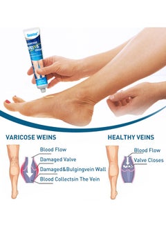 Sumifun Varicose Vein Cream For Legs, Improves Blood Circulation, Reduces Spider Veins And Heaviness, Improve Blood Circulation, Tired And Heavy Legs, 20G  - Image 5