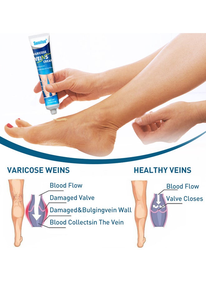 Sumifun Varicose Vein Cream For Legs, Improves Blood Circulation, Reduces Spider Veins And Heaviness, Improve Blood Circulation, Tired And Heavy Legs, 20G - Image 5