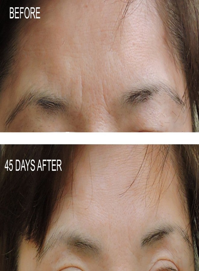 DNA Code® DIY 100% Argireline Peptides Solution Add to Your Own Cream - Image 5