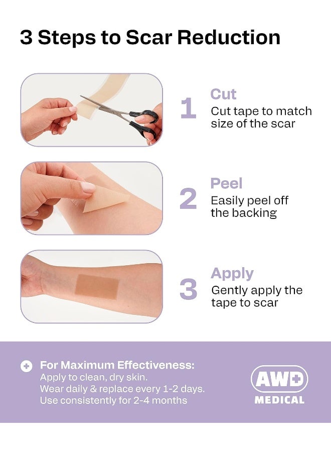 AWD Medical Silicone Scar Sheets Medical Grade Soft Silicone Gel Tape for Scar Removal (1.6” x 60”) - Pack of 3 - Image 3