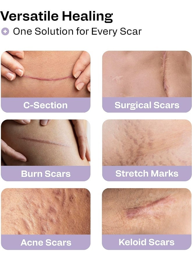 AWD Medical Silicone Scar Sheets Medical Grade Soft Silicone Gel Tape for Scar Removal (1.6” x 60”) - Pack of 3 - Image 4