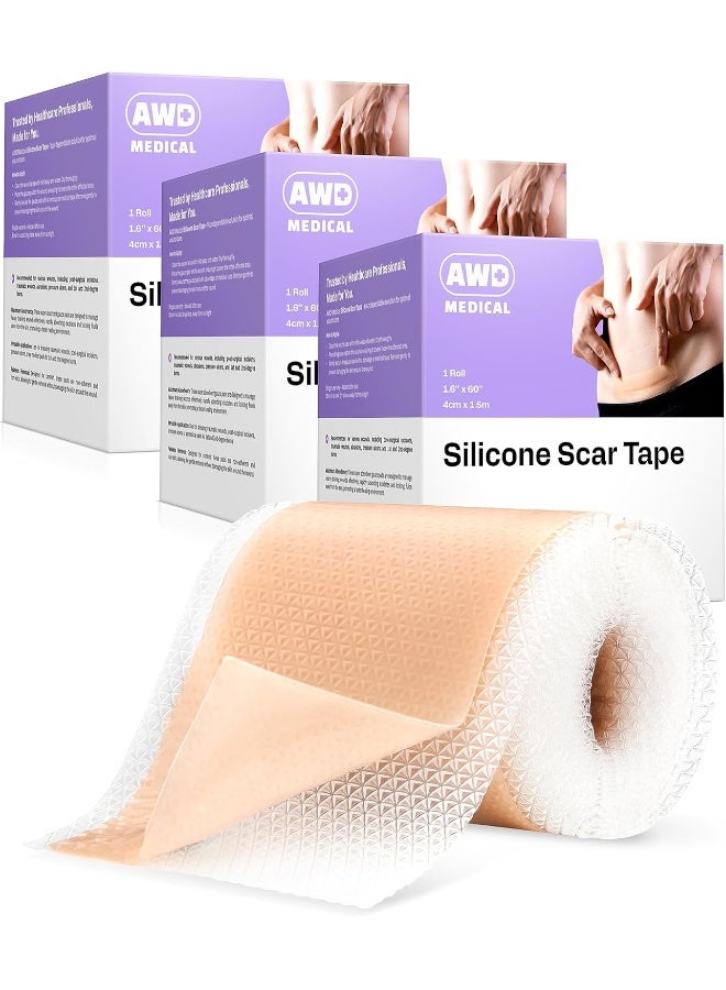 AWD Medical Silicone Scar Sheets Medical Grade Soft Silicone Gel Tape for Scar Removal (1.6” x 60”) - Pack of 3 - Image 1