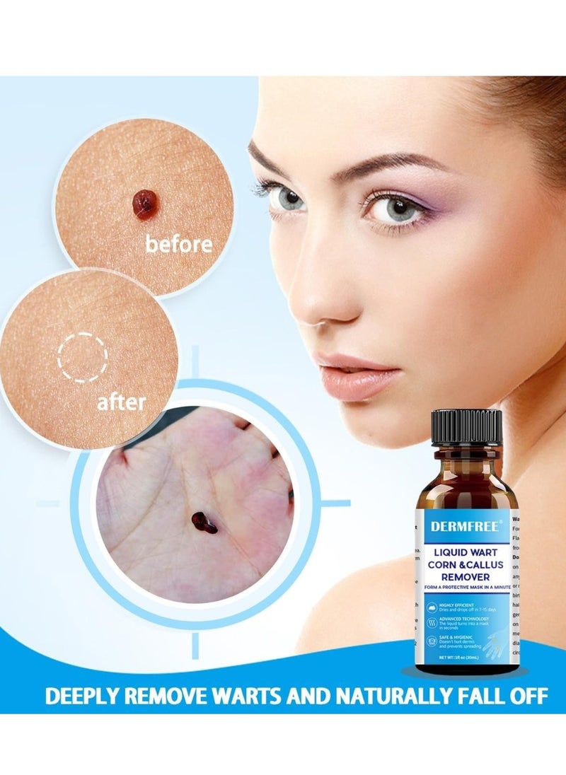 DERMFREE - Liquid Wart Corn and Callus Remover Fast Action Wart Remover Warts Removal Liquid with Salicylic Acid Remove Plantar Warts Common and Flat Wart Feet Corn Callus Treatment Liquid 30ml - Image 1