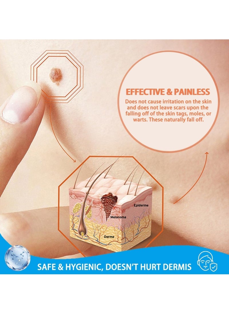 DERMFREE - Liquid Wart Corn and Callus Remover Fast Action Wart Remover Warts Removal Liquid with Salicylic Acid Remove Plantar Warts Common and Flat Wart Feet Corn Callus Treatment Liquid 30ml - Image 1