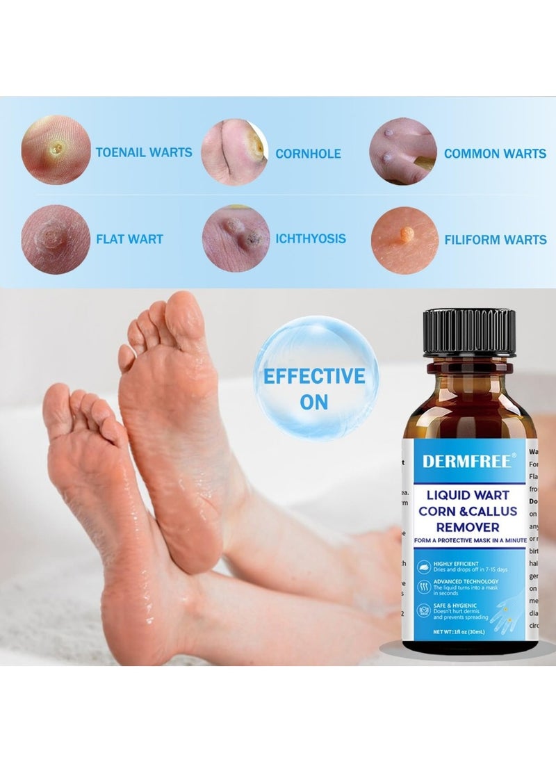 DERMFREE - Liquid Wart Corn and Callus Remover Fast Action Wart Remover Warts Removal Liquid with Salicylic Acid Remove Plantar Warts Common and Flat Wart Feet Corn Callus Treatment Liquid 30ml - Image 1