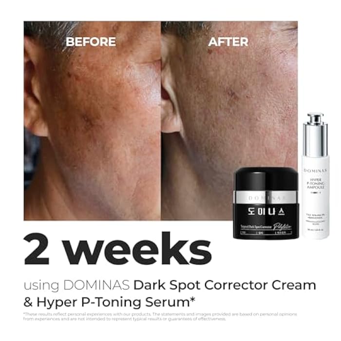 DOMINAS Dark Spot Corrector Cream | Advanced Formula with Niacinamide, TXA, Hexylresorcinol & Bakuchiol to Visibly Reduce Age Spots, Sun Spots & Uneven Tone | Korean Skincare (1.76 oz) - Image 4
