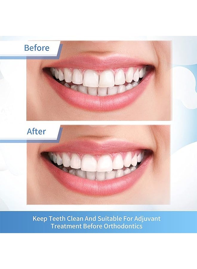 4 مم × 6 م شرائط تلميع الأسنان، أداة تنظيف الأسنان الدقيقة بالفم، طحن الراتنج تبيض سطح الأسنان -أحمر، متوسط - Image 3