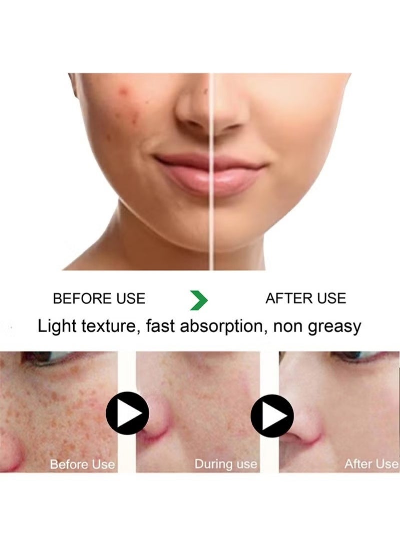 EELHOE 2PCS EELHOE Dark Spot Correcting Glow Serum3.52 fl. oz. | Brightening, Dark Spot Treatment, Anti-Aging, Acne Scars, Fine Lines, Hyperpigmentation, and Dark Circles - Image 3