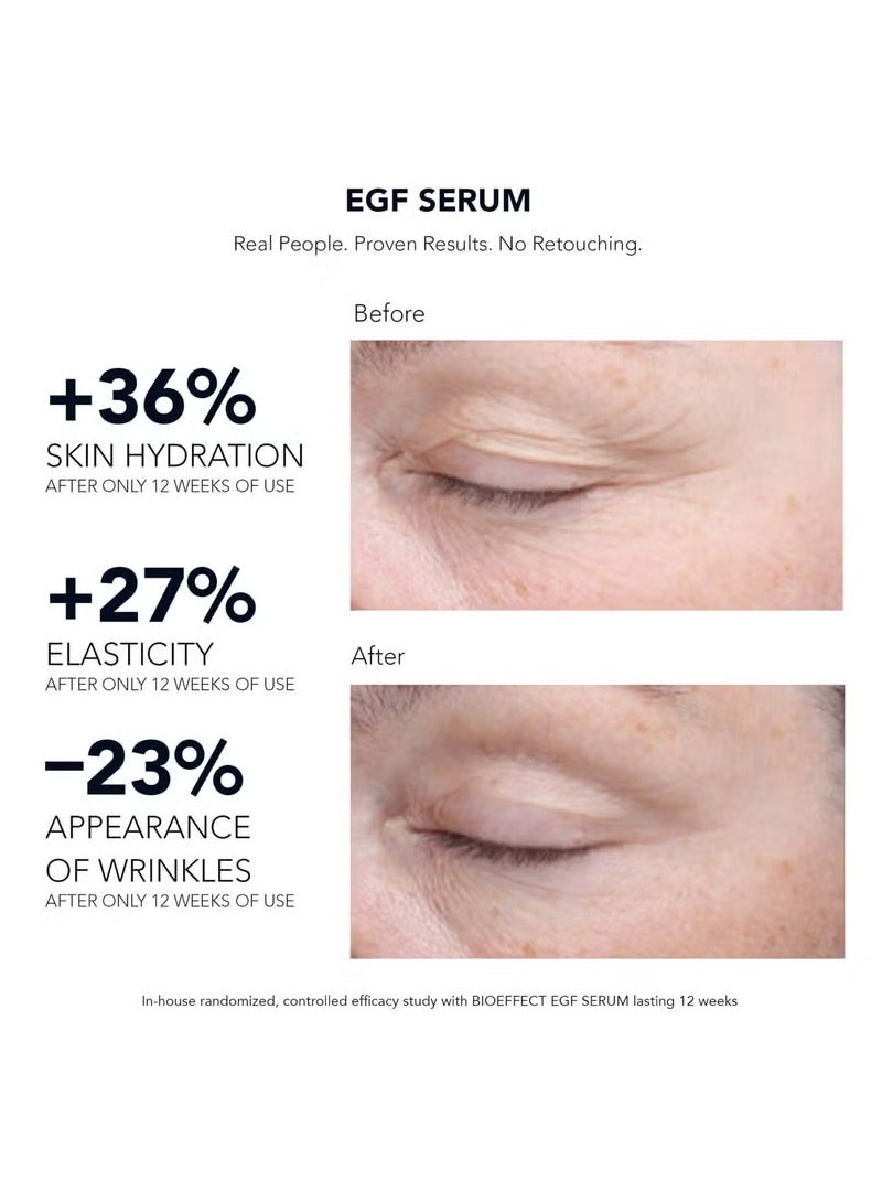 BIOEFFECT EGF Serum 15ml - Image 3