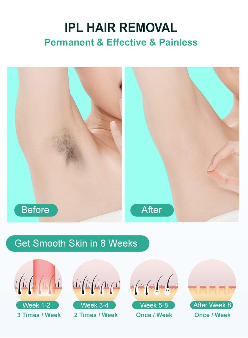 GUDOO جهاز إزالة الشعر بالليزر، جهاز إزالة الشعر الدائم غير المؤلم مع 999999 ومضة، جهاز إزالة الشعر IPL في المنزل للنساء والرجال، أرجل الوجه، بيكيني الجسم بالكامل - Image 4
