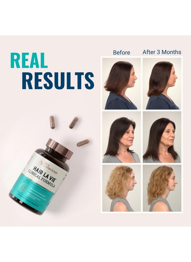 هير لي ڤيي - فيتامينات نمو الشعر Hair La Vie Live Conscious Clinical Formula للنساء والرجال مع البيوتين 5000 ميكروغرام والكولاجين والنخيل المنشاري (عبوة من قطعة واحدة) - Image 1