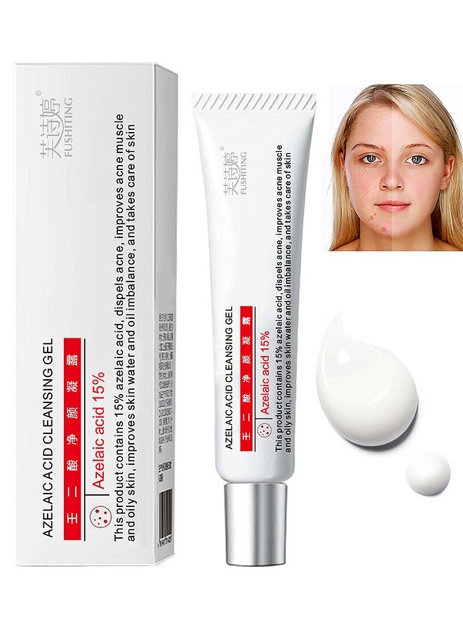 FUSHITING Azelaic Acid 15% Acne Tratment Cream, Acne Cream for Face, Spot Treatment, Anti Acne Gel For Spot Prone Skin, Rosacea Reducing Relief Pimple Breakouts Blackhead Pigmentation and Redness,Hydrate 15g - Image 1